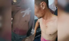 «Трое сотрудников били дубинкой и электрошокером». Житель Намангана рассказал о пытках в здании ОВД