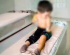 В Намангане двухлетний ребенок лишился обеих рук после удара током. Виновный понес наказание